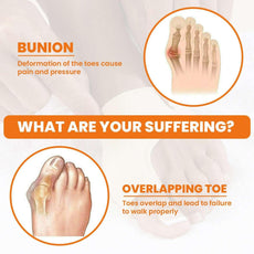 1 Pair Bunion Splint Big Toe Straightener - Puritific