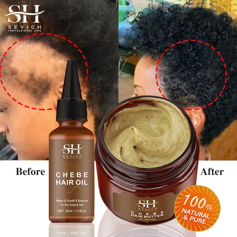 African Crazy Hair Growth Spray - Puritific