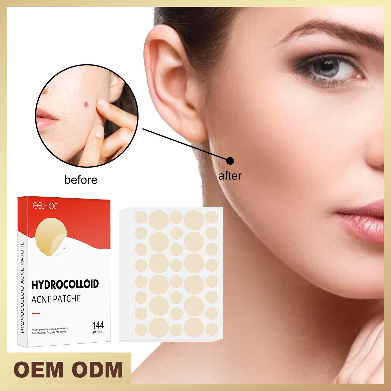 Hydrocolloid Acne Patch - Puritific