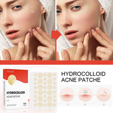 Hydrocolloid Acne Patch - Puritific