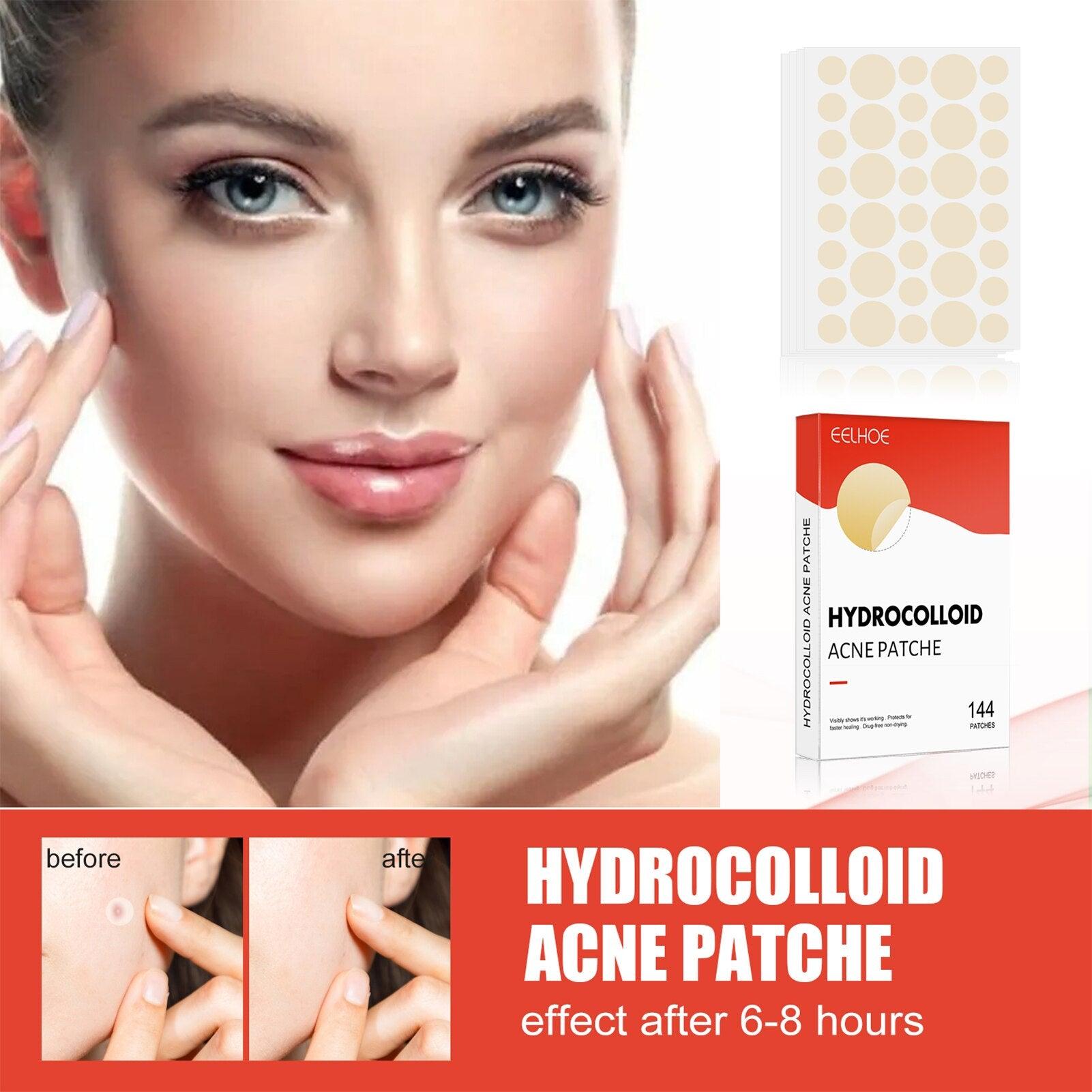 Hydrocolloid Acne Patch - Puritific