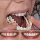 Removable Dental Lens - Puritific