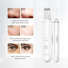 Ultrasonic Skin Lift Machine - Puritific